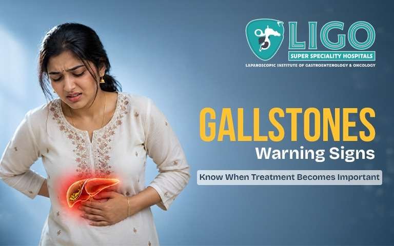 Living with gallstones and the warning signs you should not ignore